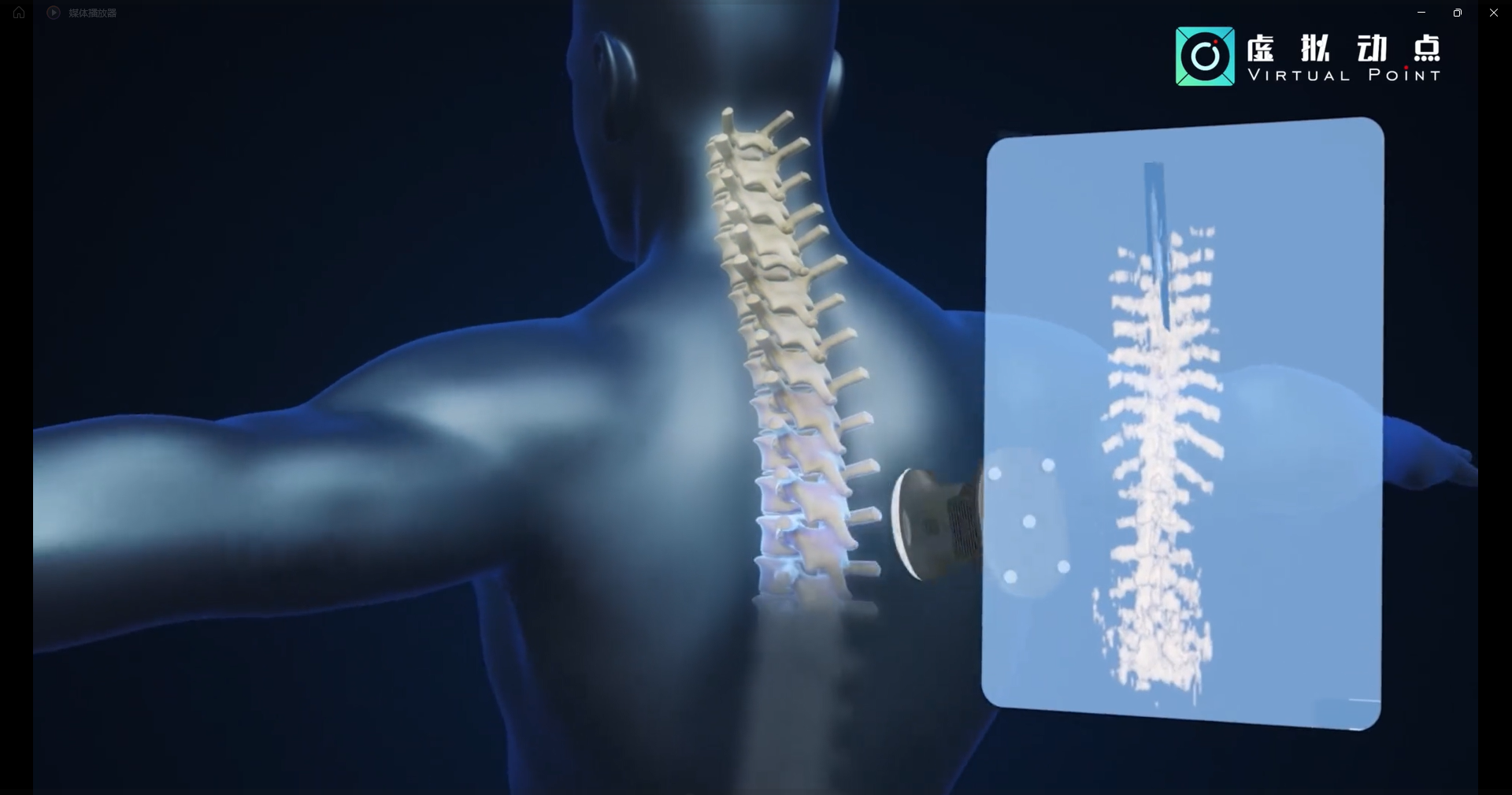 huatihui·虚拟动点OptiTrack开创3D超声成像在脊柱诊断中的应用